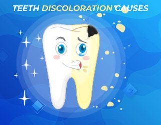 causes of tooth discoloration