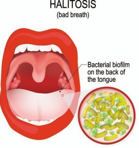 causes of chronic bad breath