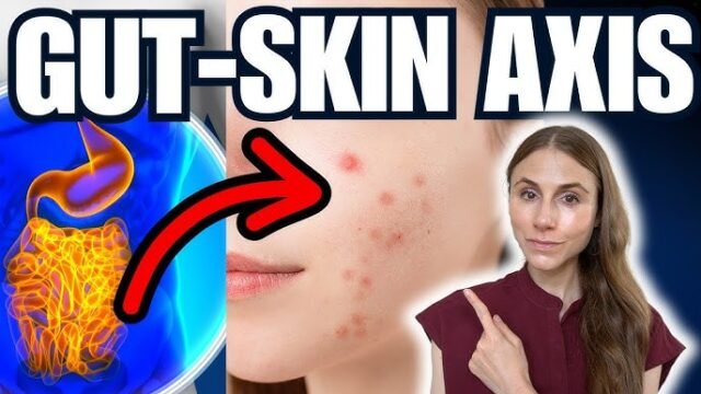 How to Support the Gut-Skin Axis for Clearer Skin How to Support the Gut-Skin Axis for Clearer Skin