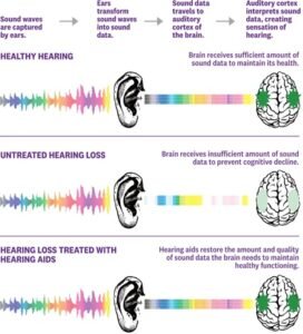 Brain Hearing Research Evidence